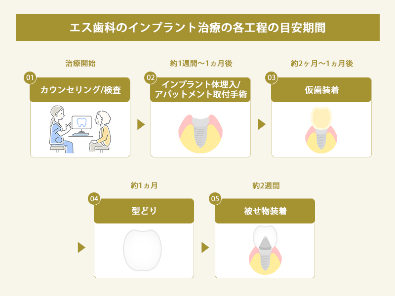 エス歯科のインプラントの治療工程と目安期間