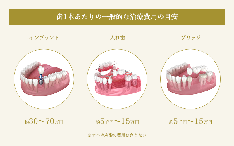 インプラントと入れ歯とブリッジの1本あたりの治療費用比較